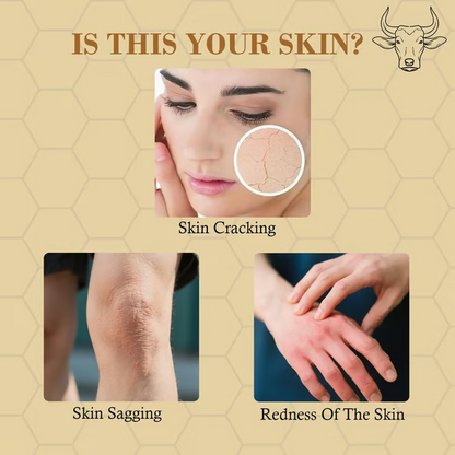 LOPEIE Whipped Grass-Fed Butter & Honey Moisturizing Cream For Soft And Smooth Skin