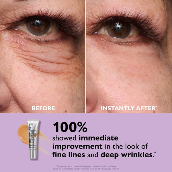 Eye Tightener Easy
